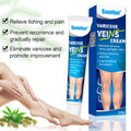 Varicose Veins Treatment for Legs