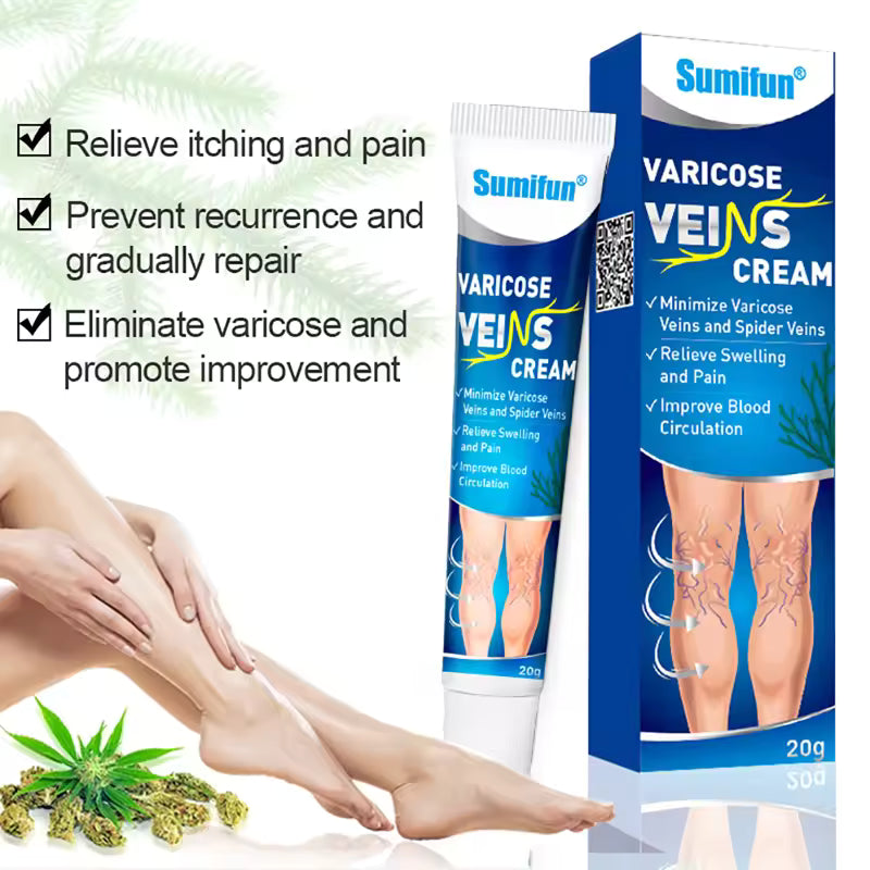Varicose Veins Treatment for Legs